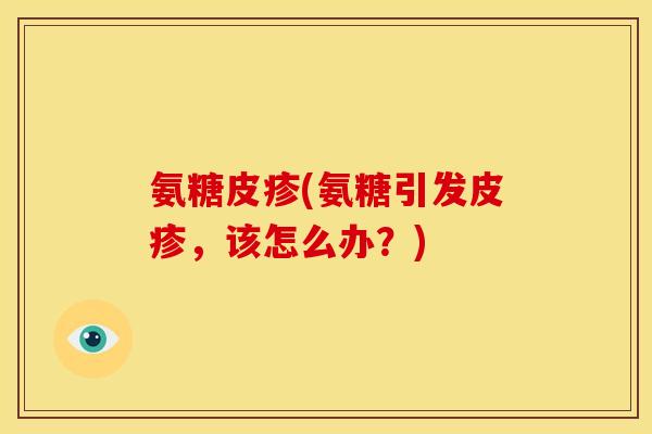 氨糖皮疹(氨糖引发皮疹，该怎么办？)