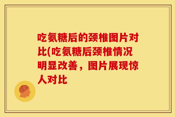 吃氨糖后的颈椎图片对比(吃氨糖后颈椎情况明显改善，图片展现惊人对比