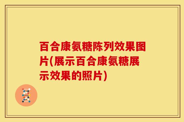 百合康氨糖陈列效果图片(展示百合康氨糖展示效果的照片)-第1张图片-关节骑士 百合康氨糖陈列效果图片(展示百合康氨糖展示效果的照片)-第1张图片-关节骑士