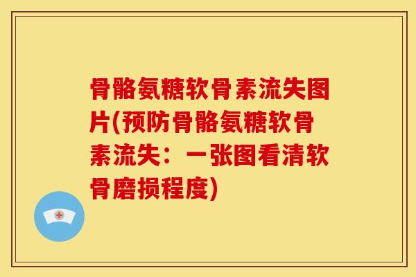 骨骼氨糖软骨素流失图片(预防骨骼氨糖软骨素流失：一张图看清软骨磨损程度)