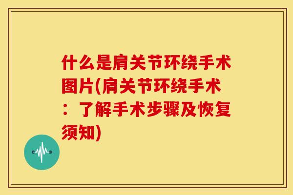 什么是肩关节环绕手术图片(肩关节环绕手术：了解手术步骤及恢复须知)