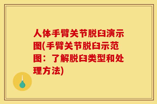 人体手臂关节脱臼演示图(手臂关节脱臼示范图：了解脱臼类型和处理方法)