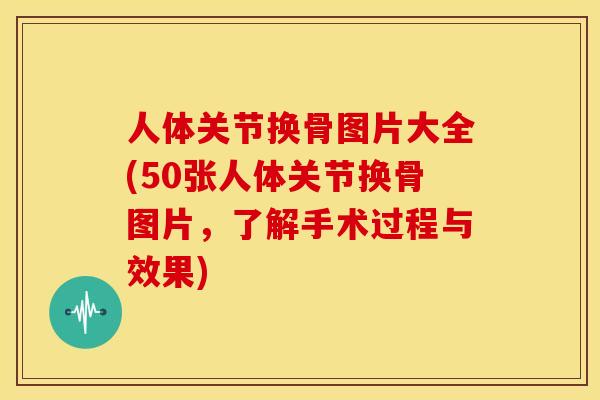人体关节换骨图片大全(50张人体关节换骨图片，了解手术过程与效果)