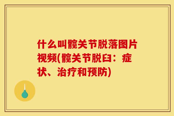 什么叫髋关节脱落图片视频(髋关节脱臼：症状、治疗和预防)