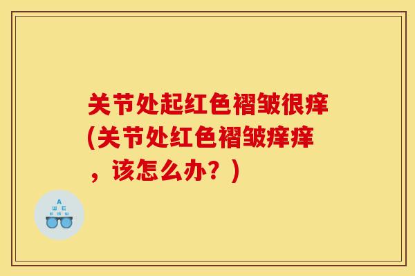 关节处起红色褶皱很痒(关节处红色褶皱痒痒，该怎么办？)