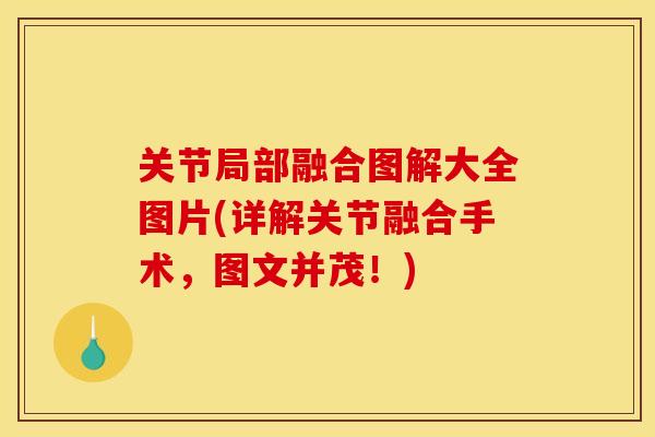 关节局部融合图解大全图片(详解关节融合手术，图文并茂！)