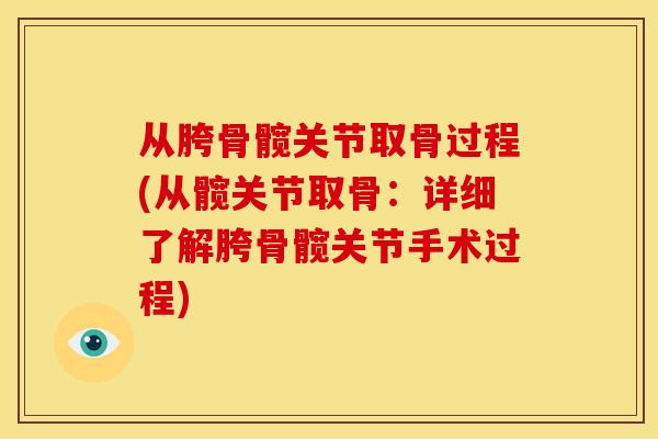 从胯骨髋关节取骨过程(从髋关节取骨：详细了解胯骨髋关节手术过程)