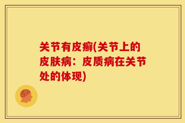 关节有皮癣(关节上的皮肤病：皮质病在关节处的体现)