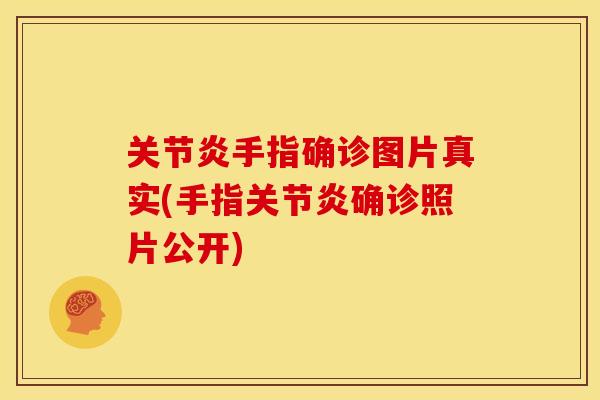 关节炎手指确诊图片真实(手指关节炎确诊照片公开)