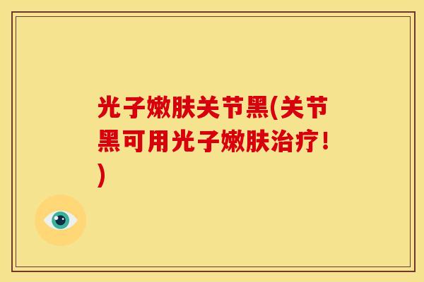 光子嫩肤关节黑(关节黑可用光子嫩肤治疗！)