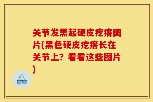 关节发黑起硬皮疙瘩图片(黑色硬皮疙瘩长在关节上？看看这些图片)