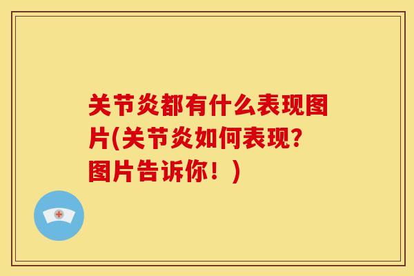 关节炎都有什么表现图片(关节炎如何表现？图片告诉你！)