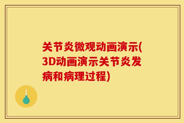 关节炎微观动画演示(3D动画演示关节炎发病和病理过程)