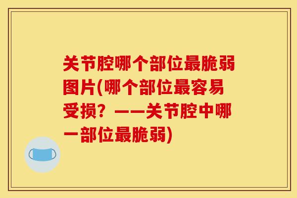 关节腔哪个部位最脆弱图片(哪个部位最容易受损？——关节腔中哪一部位最脆弱)