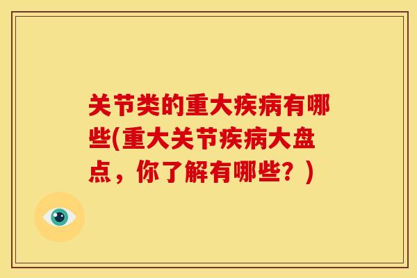 关节类的重大疾病有哪些(重大关节疾病大盘点,你了解有哪些?)-第1张图片-关节骑士 关节类的重大疾病有哪些(重大关节疾病大盘点,你了解有哪些?)-第1张图片-关节骑士