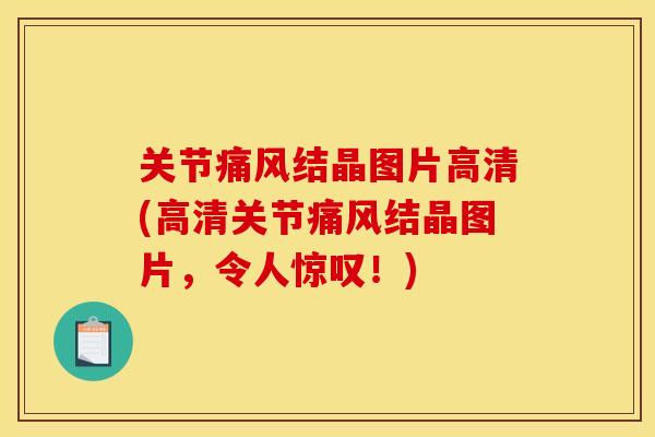 关节痛风结晶图片高清(高清关节痛风结晶图片，令人惊叹！)