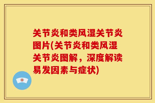 关节炎和类风湿关节炎图片(关节炎和类风湿关节炎图解，深度解读易发因素与症状)