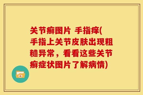 关节癣图片 手指痒(手指上关节皮肤出现粗糙异常，看看这些关节癣症状图片了解病情)