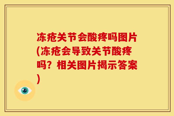 冻疮关节会酸疼吗图片(冻疮会导致关节酸疼吗？相关图片揭示答案)