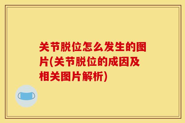 关节脱位怎么发生的图片(关节脱位的成因及相关图片解析)