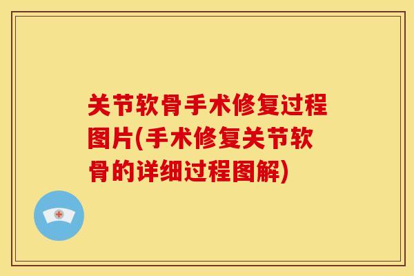 关节软骨手术修复过程图片(手术修复关节软骨的详细过程图解)