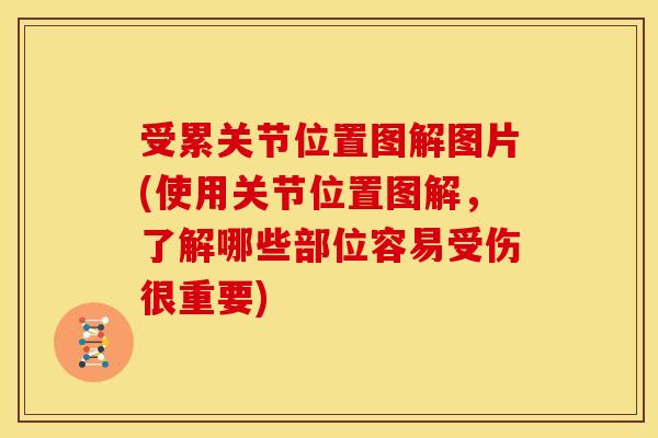 受累关节位置图解图片(使用关节位置图解，了解哪些部位容易受伤很重要)