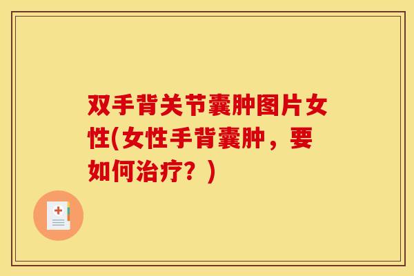 双手背关节囊肿图片女性(女性手背囊肿，要如何治疗？)-第1张图片-关节骑士