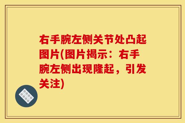 右手腕左侧关节处凸起图片(图片揭示：右手腕左侧出现隆起，引发关注)