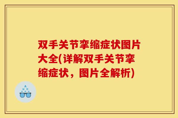 双手关节挛缩症状图片大全(详解双手关节挛缩症状，图片全解析)