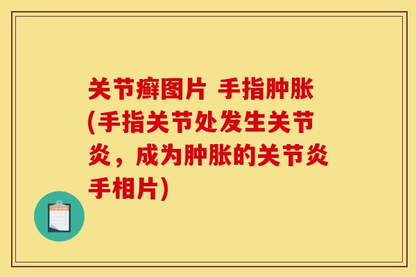 关节癣图片 手指肿胀(手指关节处发生关节炎，成为肿胀的关节炎手相片)