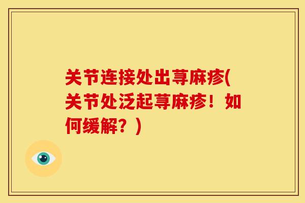 关节连接处出荨麻疹(关节处泛起荨麻疹！如何缓解？)-第1张图片-关节骑士