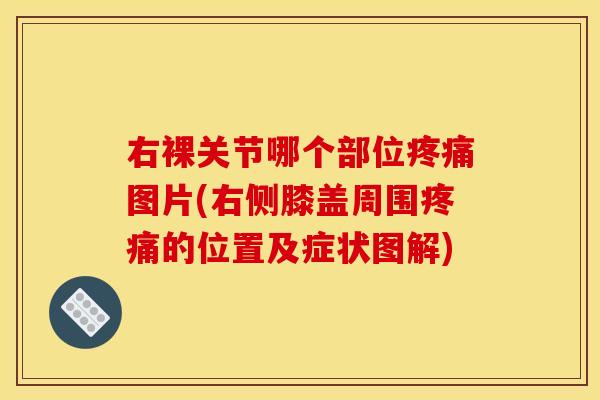 右裸关节哪个部位疼痛图片(右侧膝盖周围疼痛的位置及症状图解)