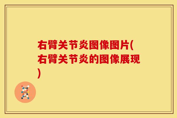 右臂关节炎图像图片(右臂关节炎的图像展现)