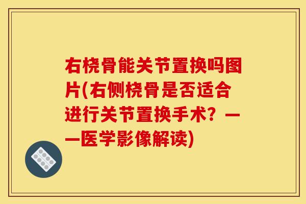 右桡骨能关节置换吗图片(右侧桡骨是否适合进行关节置换手术？——医学影像解读)