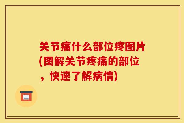关节痛什么部位疼图片(图解关节疼痛的部位，快速了解病情)