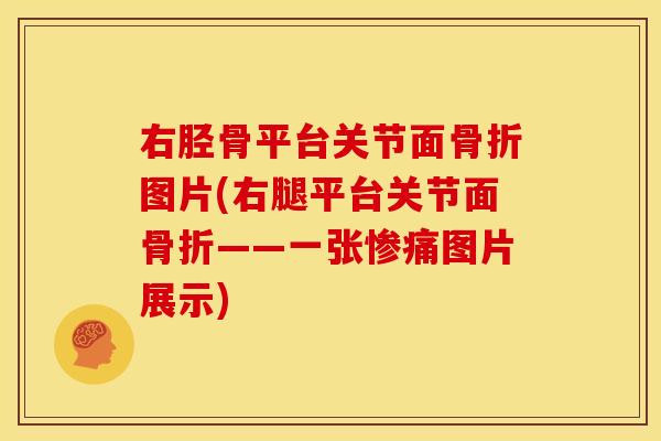 右胫骨平台关节面骨折图片(右腿平台关节面骨折——一张惨痛图片展示)