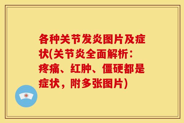 各种关节发炎图片及症状(关节炎全面解析：疼痛、红肿、僵硬都是症状，附多张图片)