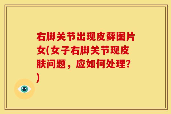 右脚关节出现皮藓图片女(女子右脚关节现皮肤问题，应如何处理？)