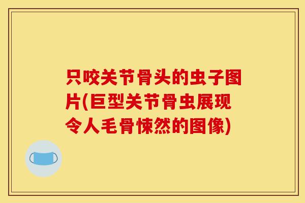 只咬关节骨头的虫子图片(巨型关节骨虫展现令人毛骨悚然的图像)-第1张图片-关节骑士 只咬关节骨头的虫子图片(巨型关节骨虫展现令人毛骨悚然的图像)-第1张图片-关节骑士