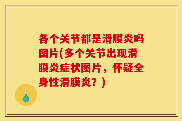 各个关节都是滑膜炎吗图片(多个关节出现滑膜炎症状图片，怀疑全身性滑膜炎？)