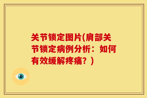 关节锁定图片(肩部关节锁定病例分析：如何有效缓解疼痛？)