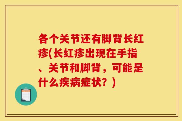 各个关节还有脚背长红疹(长红疹出现在手指、关节和脚背，可能是什么疾病症状？)