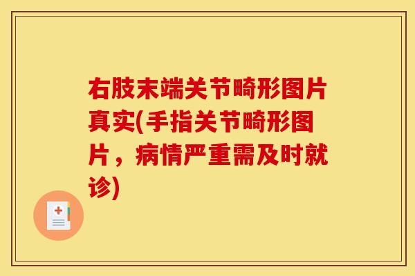 右肢末端关节畸形图片真实(手指关节畸形图片，病情严重需及时就诊)