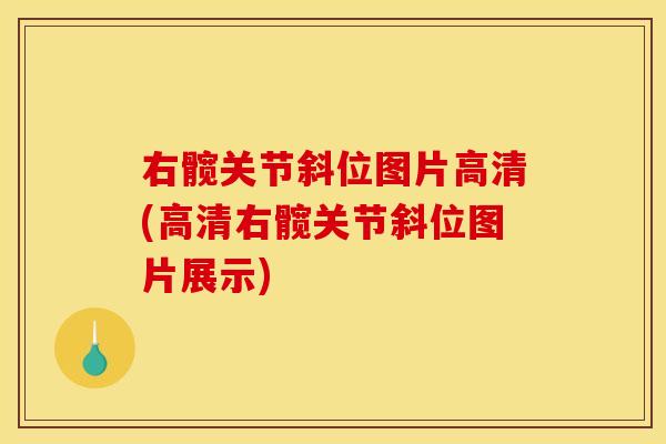 右髋关节斜位图片高清(高清右髋关节斜位图片展示)