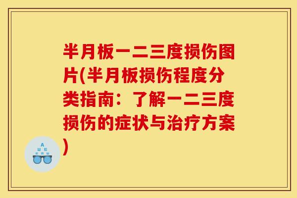 半月板一二三度损伤图片(半月板损伤程度分类指南：了解一二三度损伤的症状与治疗方案)
