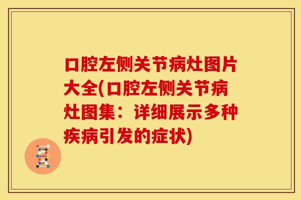 口腔左侧关节病灶图片大全(口腔左侧关节病灶图集：详细展示多种疾病引发的症状)