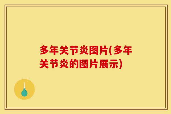 多年关节炎图片(多年关节炎的图片展示)