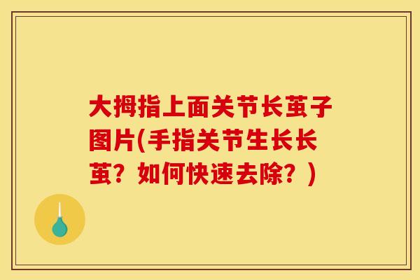 大拇指上面关节长茧子图片(手指关节生长长茧？如何快速去除？)