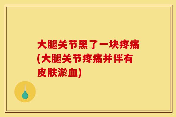 大腿关节黑了一块疼痛(大腿关节疼痛并伴有皮肤淤血)