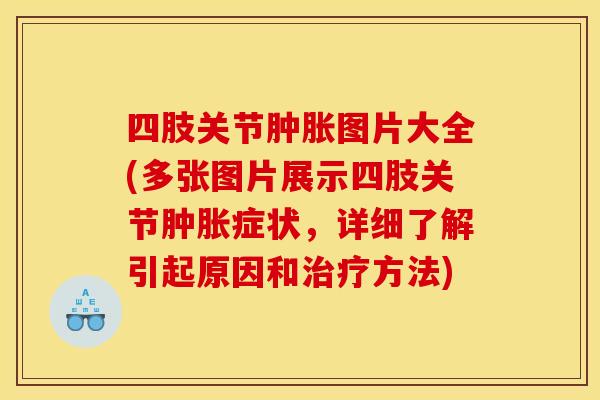 四肢关节肿胀图片大全(多张图片展示四肢关节肿胀症状，详细了解引起原因和治疗方法)